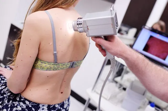 Videodermatoskop - jak działa i do czego służy?